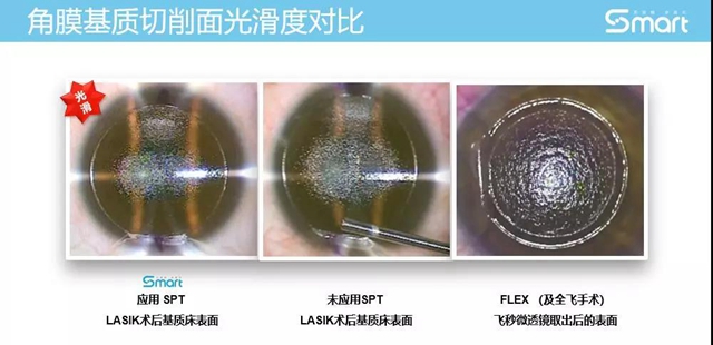 【關(guān)注】女兵報(bào)名已經(jīng)開(kāi)始，可視力不達(dá)標(biāo)怎么辦？(圖8)