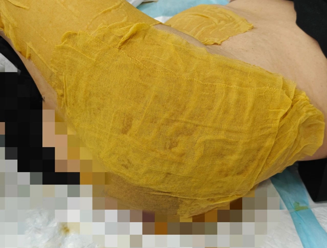 【圍觀】毒蛇鉆進(jìn)女子被窩，先咬PP后鎖喉...…