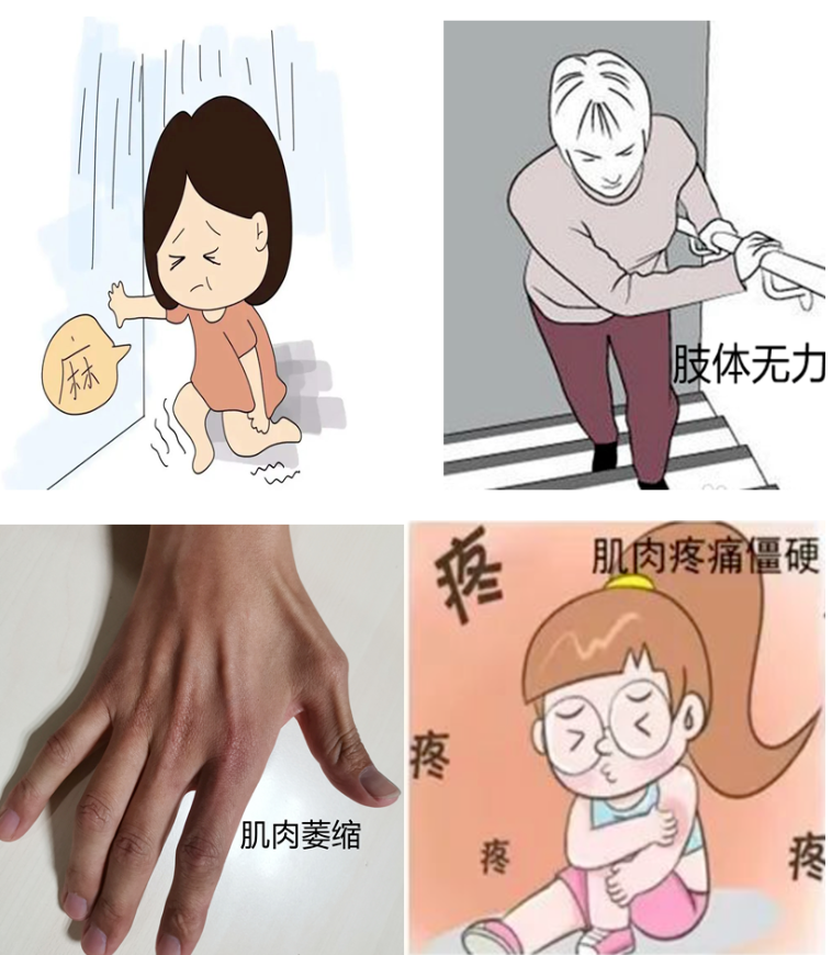 【技術】肌電圖檢查——讓您的神經(jīng)、肌肉會“說話”！