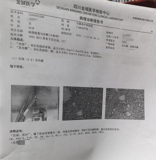 絕經(jīng)后，下腹反復(fù)疼痛，小心這個(gè)疾病在“作祟”！！