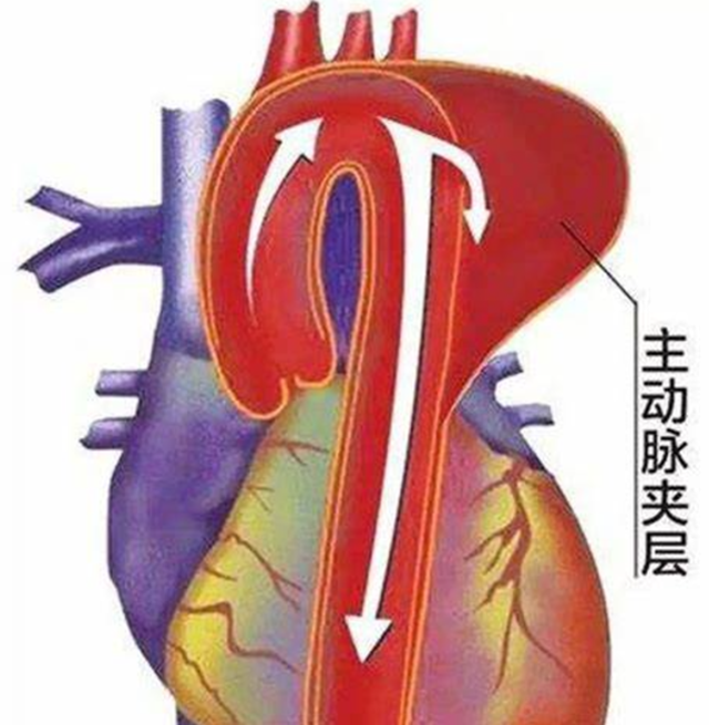 【警惕】冬季高發(fā)，男子倒地不起：“痛到像整個(gè)人被撕開(kāi)！”