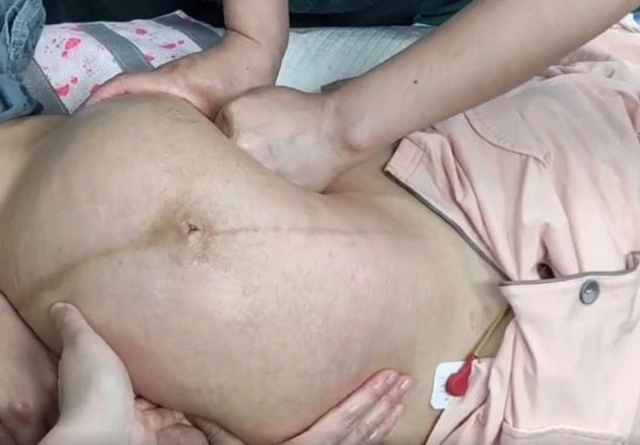 【厲害】又一例！2秒鐘，醫(yī)生徒手扭轉(zhuǎn)胎位不正