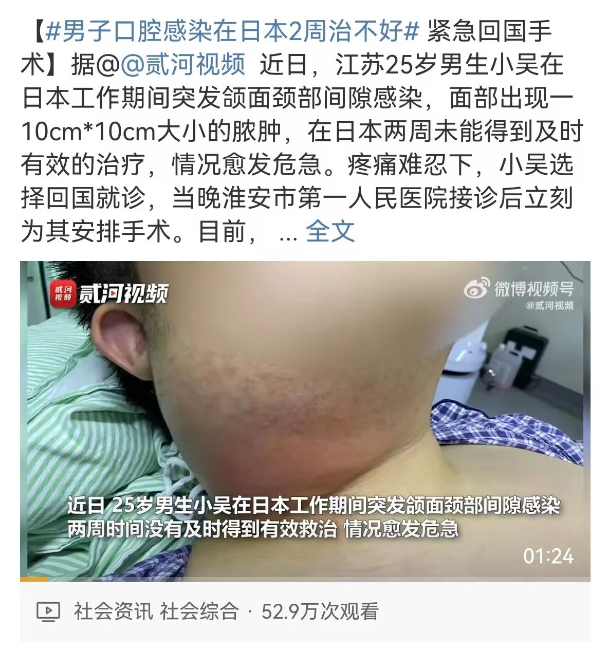 【圍觀】瀘州女子半邊臉腫成球！當(dāng)天“切開”……