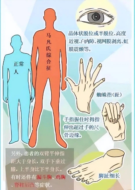 【醫(yī)患故事】險(xiǎn)象環(huán)生，男子5進(jìn)鬼門(mén)關(guān)，多科協(xié)作成功救治