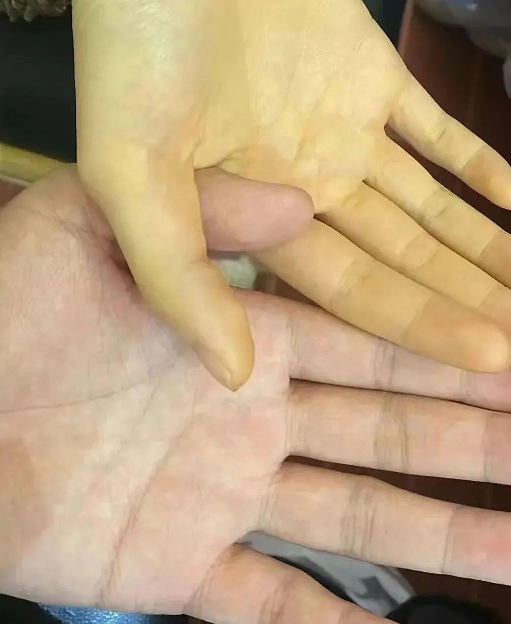 【警惕】這個(gè)水果每天最多吃5個(gè)，吃多了真的要變黃