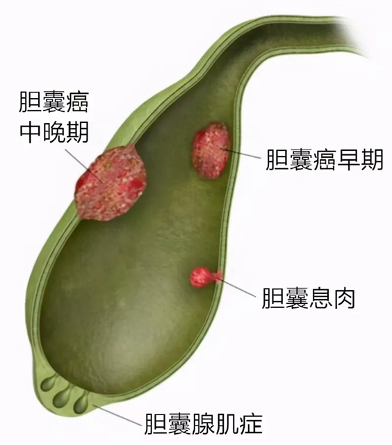 護士4.jpg