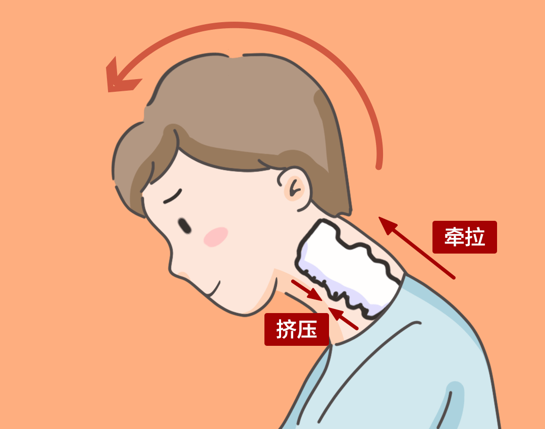 【警惕】長(zhǎng)時(shí)間低頭玩手機(jī)？怪不得經(jīng)常頭痛……