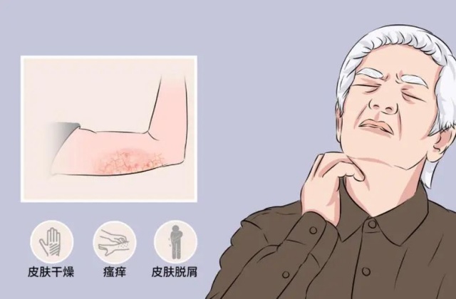 老年瘙癢癥：72歲的老伯，全身癢得睡不著！