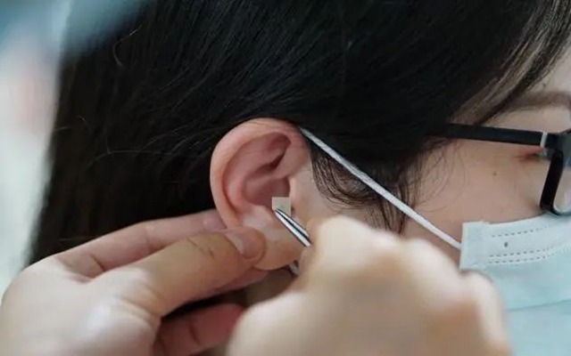 【耳穴埋豆】藏在耳朵上的減肥開關(guān)：選對穴位，減肥加倍