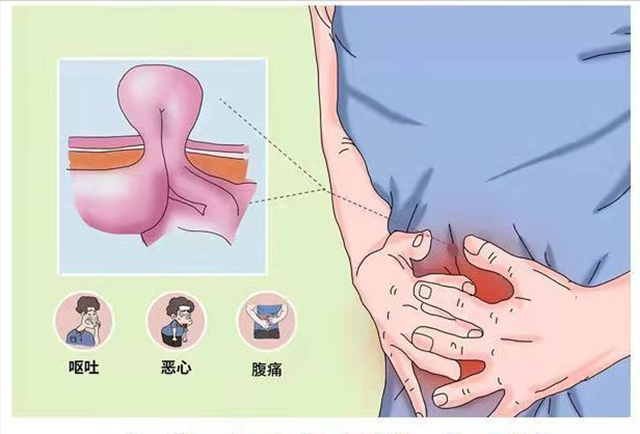 【關(guān)注】大爺肚子鼓起半個(gè)“足球”大包，竟是……