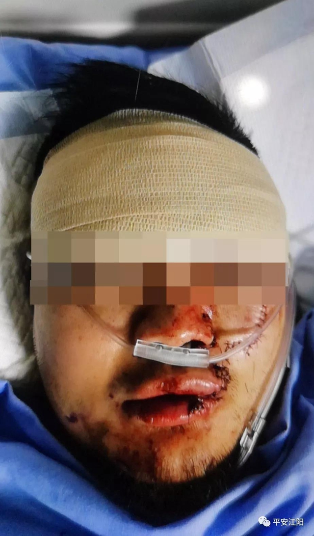 警方發(fā)布：匯通超市不戴口罩打人男子已到案 被抓時(shí)躺醫(yī)院臉縫數(shù)針……(圖5)