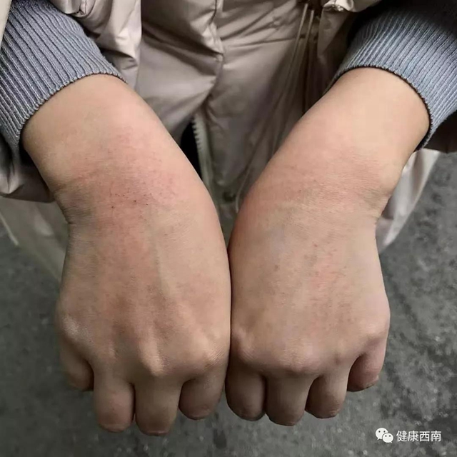 西南醫(yī)大附院援鄂日志：等戰(zhàn)“疫”勝利了，我們?nèi)コ詿岣擅妫?圖8)