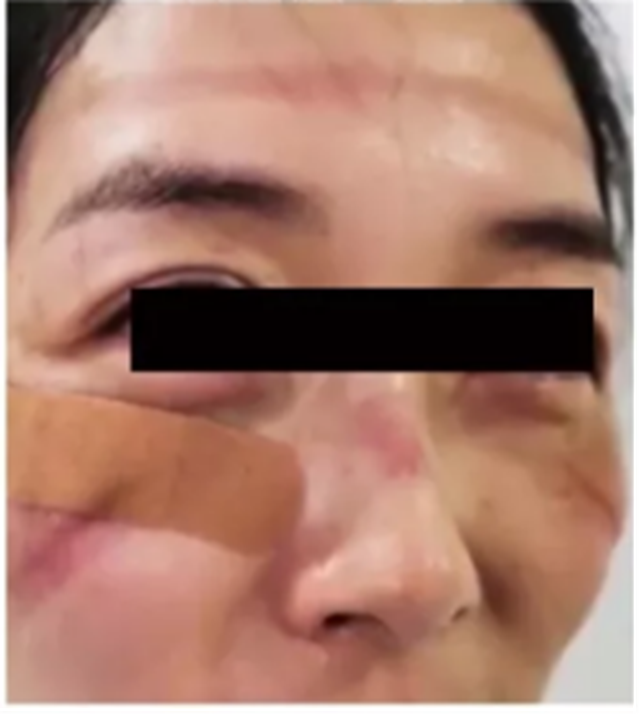【西南醫(yī)大附院皮膚科?美貌秘籍】學(xué)會這些，呵護你口罩下的美麗！(圖3)