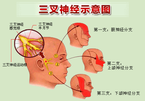 大媽被拔光牙齒，沒(méi)想到得的是三叉神經(jīng)痛！(圖4)