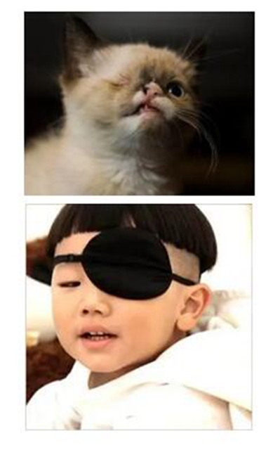 【險情】鐵屑飛進眼睛，男子差點失明！