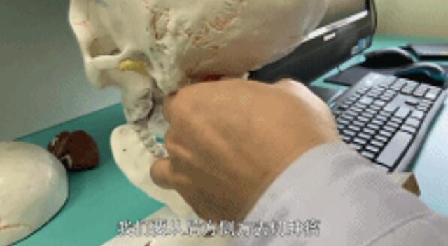 開始只是手指發(fā)麻，一查竟是顱內(nèi)腫瘤！差點(diǎn)就癱瘓……(圖4)