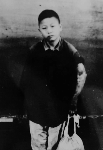 【歲月流金·70年史跡】各種高難度手術，70年代西南醫(yī)大附院已名揚四海(圖5)