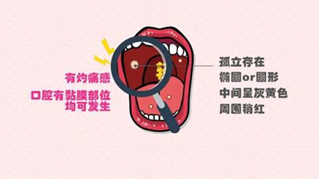 口腔潰瘍別總怪“上火”，3個tips拯救你！
