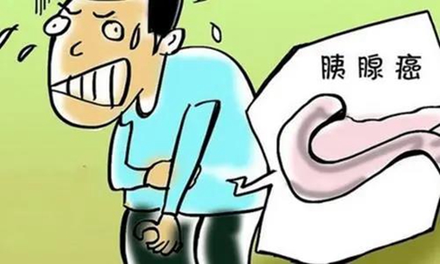 【警惕】身體出現(xiàn)三個危險信號，當心“癌中之王”！(圖3)