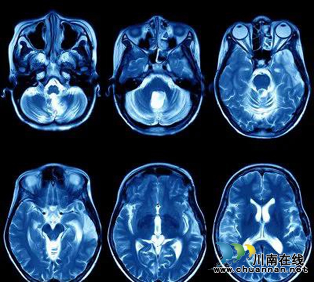 它來啦！“這個大物件”即將在瀘州骨病醫(yī)院投入使用(圖4)