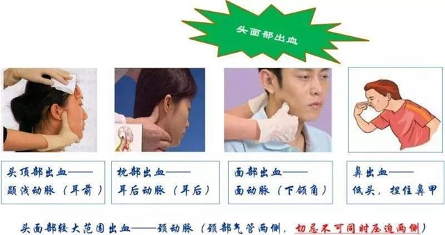 【關(guān)注】七旬婆婆意外摔傷頭部，流血不止……(圖4)