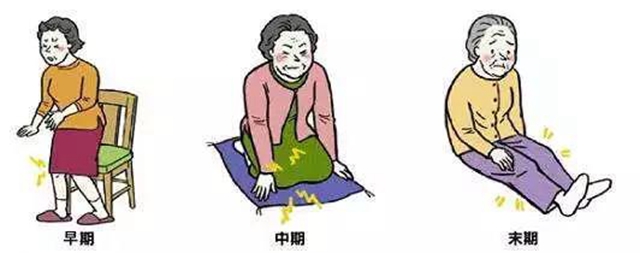 長(zhǎng)假即將結(jié)束，發(fā)現(xiàn)膝關(guān)節(jié)腫脹、關(guān)節(jié)炎怎么辦？(圖3)