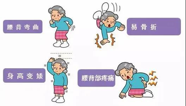 【擴(kuò)散】只要1分鐘，測(cè)測(cè)你患骨質(zhì)疏松的風(fēng)險(xiǎn)？(圖1)