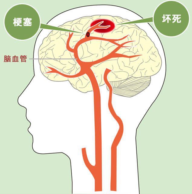 【冬季高發(fā)】6個(gè)危險(xiǎn)信號(hào)一定要警惕！(圖4)