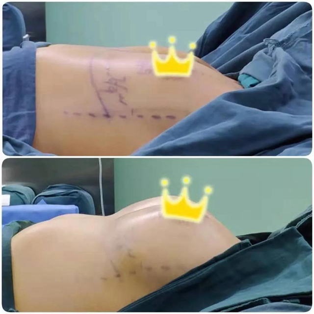 【圍觀】帥氣男醫(yī)生出手！30歲辣媽重回C罩杯？(圖6)