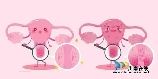【關(guān)注】晚期卵巢癌患者遇見(jiàn)男神毛教授會(huì)怎樣？(圖9)