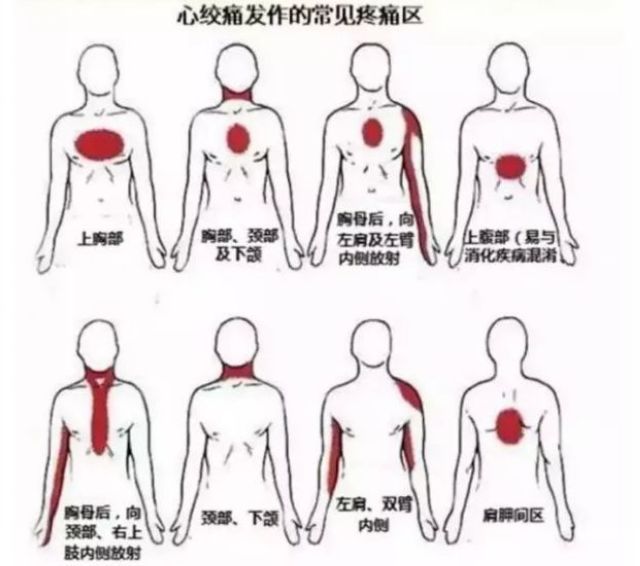 你的心臟在求救！急性心梗的這些預(yù)警信號(hào)， 你知道嗎？(圖8)