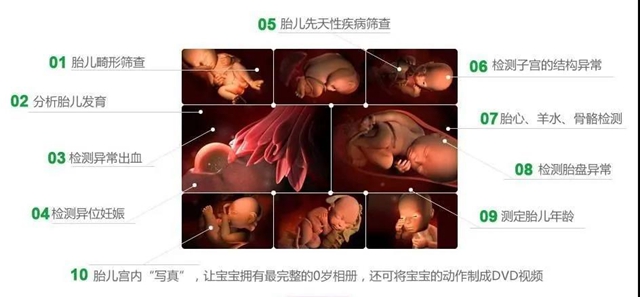 【擴散】害怕寶寶先天畸形？這項檢查不可忽視！(圖5)