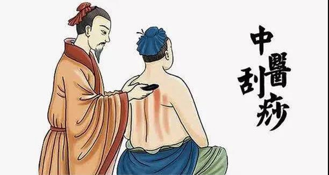 【注意】你對刮痧感興趣？但這些人千萬別刮！