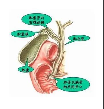 【警惕】小伙聚餐后，腹部突然劇痛！竟是……(圖4)