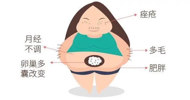 【提醒】女性多毛、月經(jīng)紊亂、痤瘡，當(dāng)心得了這個(gè)?。?圖2)