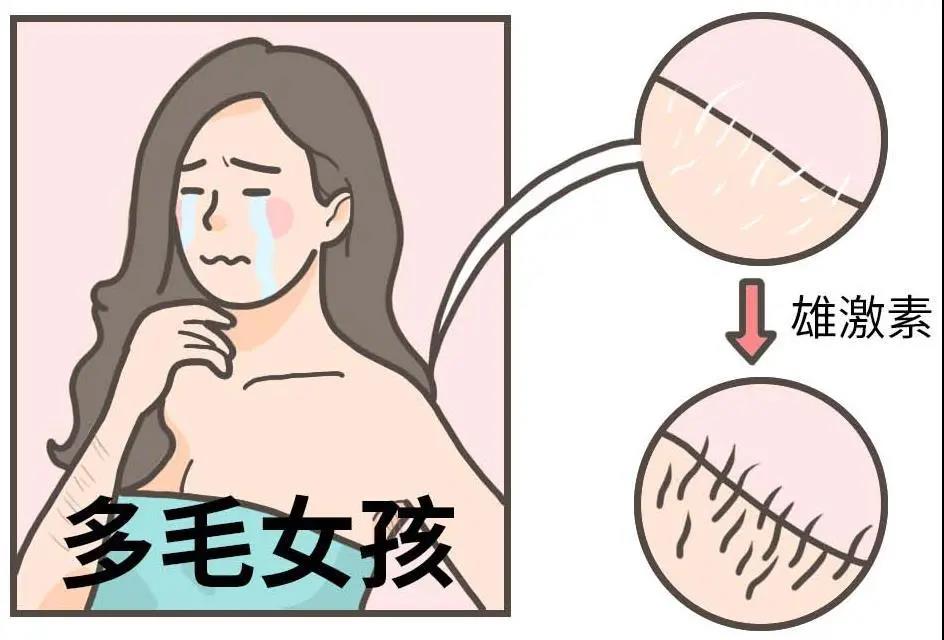 【提醒】女性多毛、月經(jīng)紊亂、痤瘡，當(dāng)心得了這個(gè)??！(圖6)