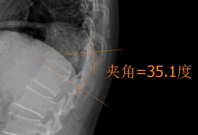 【圍觀】瀘州又一52歲孃孃，更厲害了！(圖3)