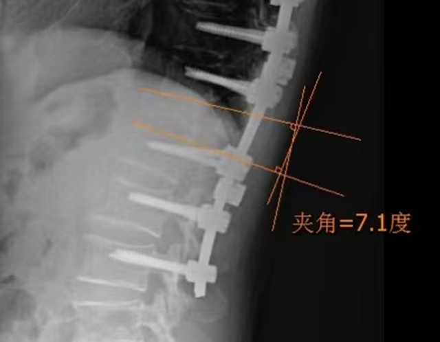 【圍觀】瀘州又一52歲孃孃，更厲害了！(圖6)