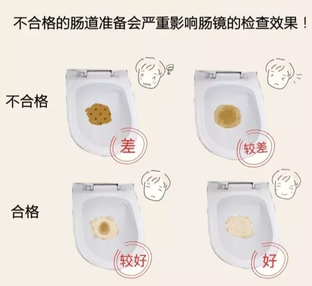 【擴散】高大上！做胃腸鏡有新變化？(圖16)