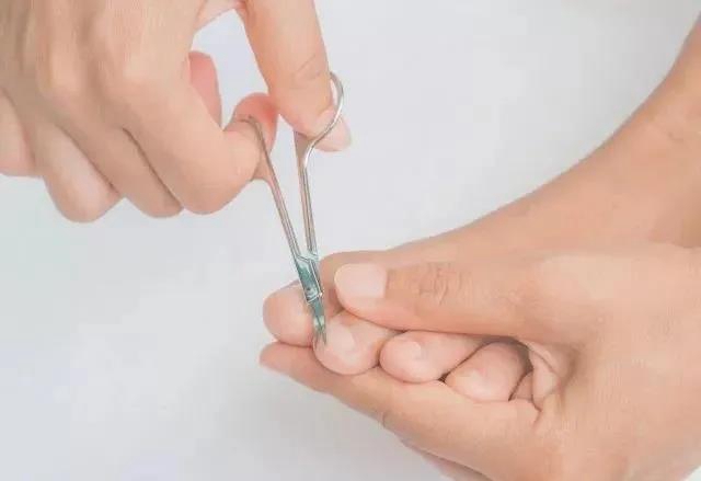 【擴(kuò)散】腳指甲剪很短，感覺很爽？！代價卻很……