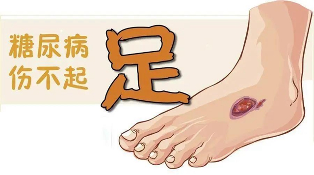 【擴散】腳指甲剪很短，感覺很爽？！代價卻很……(圖4)