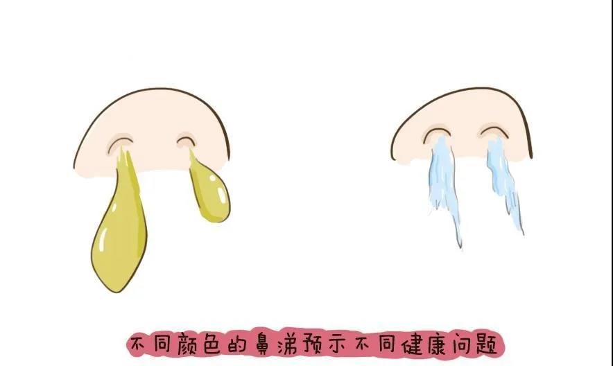 【擴(kuò)散】流鼻涕≠感冒，出現(xiàn)這些顏色的鼻涕要當(dāng)心！(圖4)