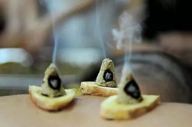 冬病夏治，正當(dāng)時(shí)！ 瀘州市中醫(yī)院喊您來貼“三伏灸”啦！