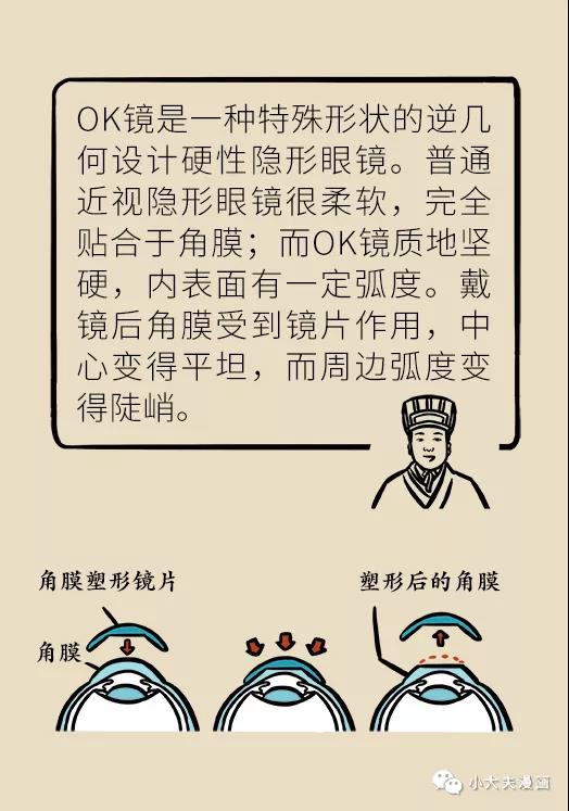 暑假到，配鏡忙，OK鏡真能緩解孩子近視？看專家解答(圖7)