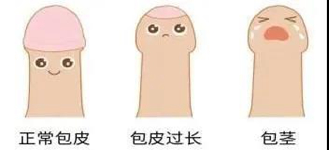 暑期——小兒包皮手術(shù)的最佳時機，您可千萬別錯過！