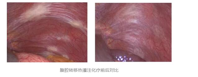 【關(guān)注】43℃高溫下，被燙死了……(圖8)