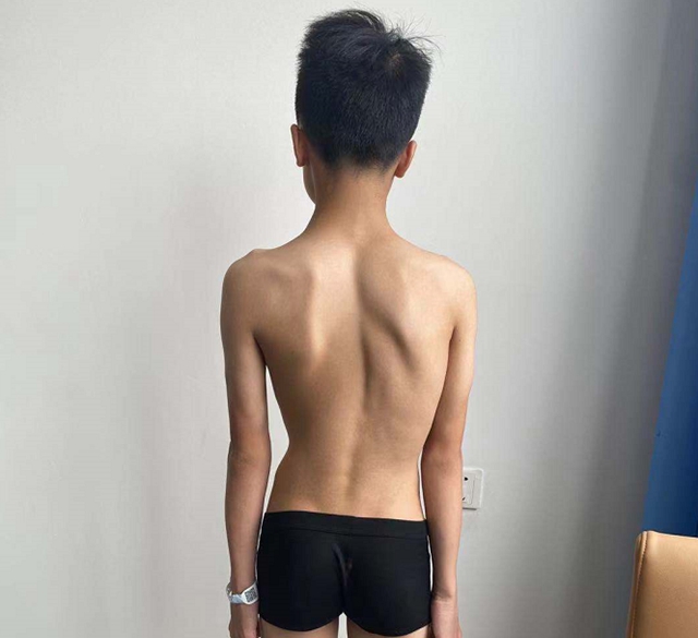【擴散】瀘州12歲男孩為何突然長高3公分？(圖4)