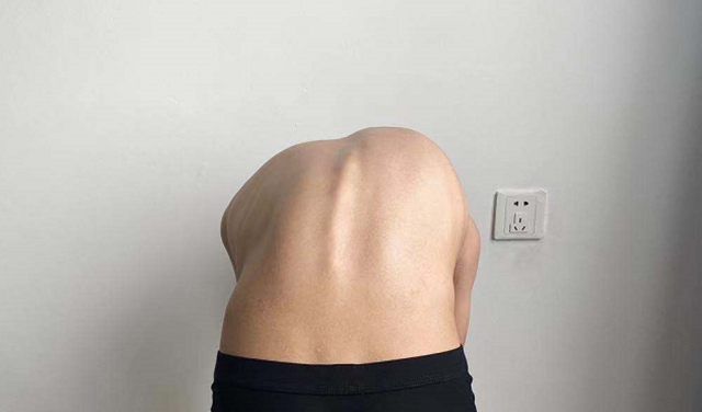 【擴散】瀘州12歲男孩為何突然長高3公分？(圖5)