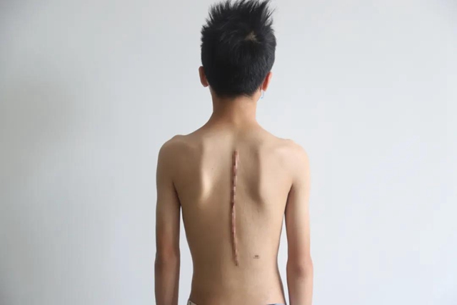 【擴散】瀘州12歲男孩為何突然長高3公分？(圖7)