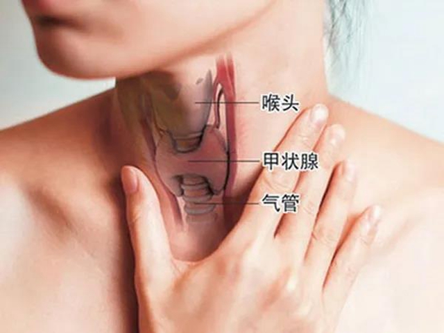 【關(guān)注】這個(gè)“善良的癌癥”，女性發(fā)病率是男性的3倍！(圖3)